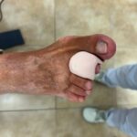 siliconas podológicas a medida