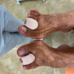 siliconas podológicas a medida