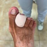 siliconas podológicas a medida