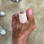 siliconas podológicas a medida