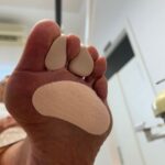 siliconas podológicas a medida